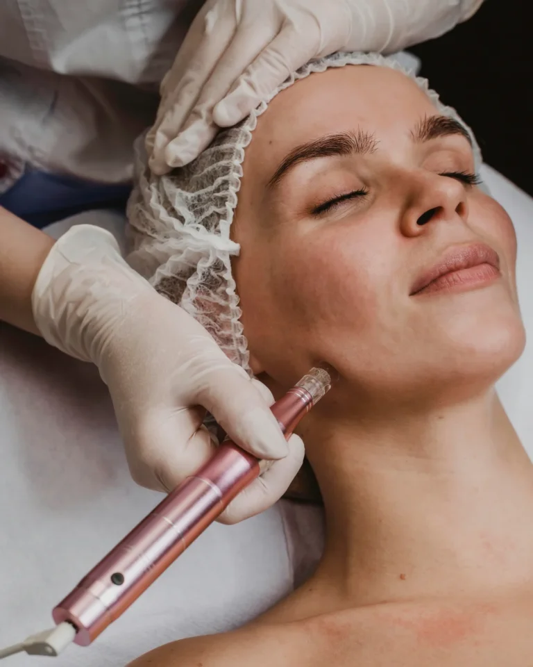 Micropuncture – advanced regeneration therapy